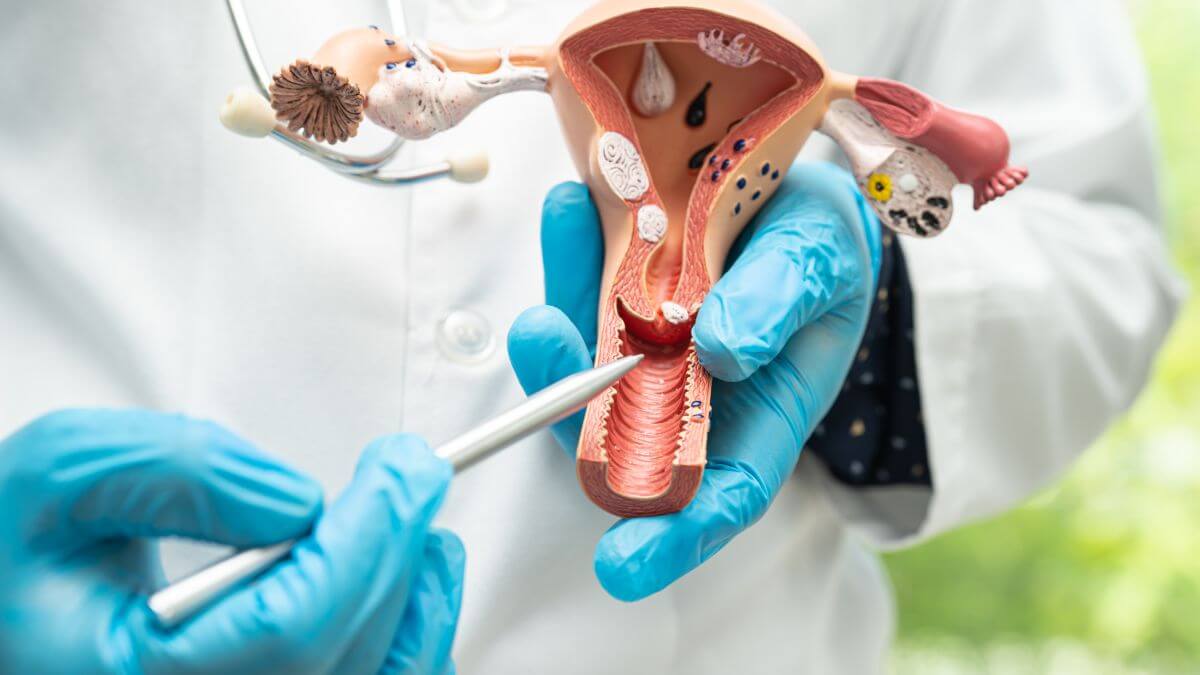 Médico explicando como as endometrites podem afetar e fertilidade